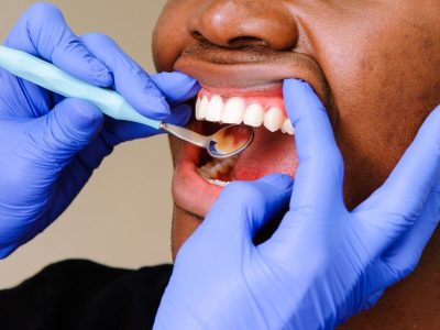 african-male-patient-getting-dental-treatment-dental-cli_002