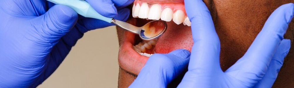 african-male-patient-getting-dental-treatment-dental-cli_002 african-male-patient-getting-dental-treatment-dental-cli_002